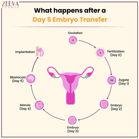 No symptoms at all. . 10 days after embryo transfer symptoms